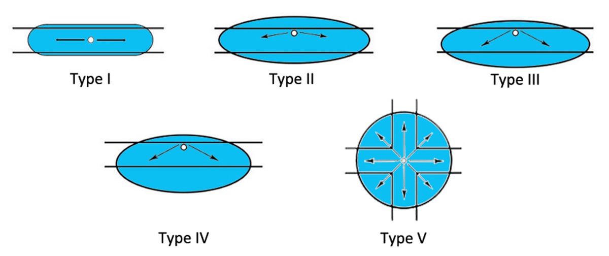 IESNA lighting distribution types